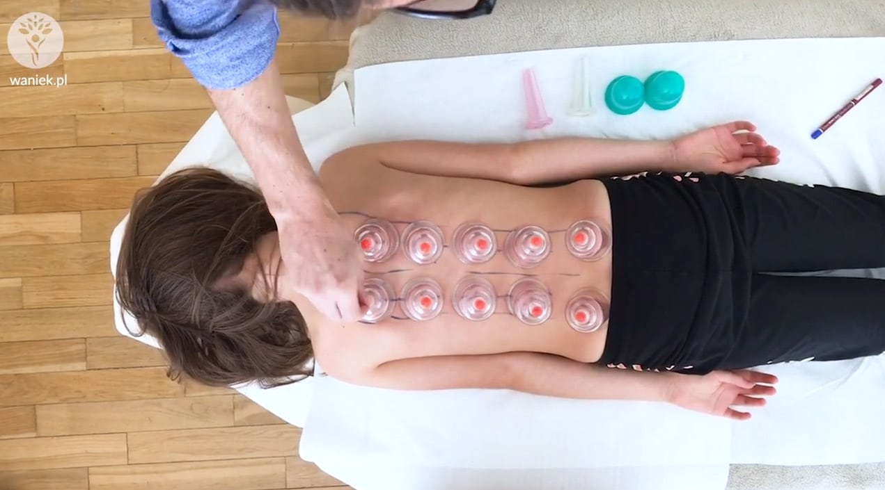 Bańki wzmacniające i lecznice - Poradnik